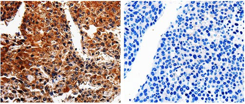 ABCB8 Antibody