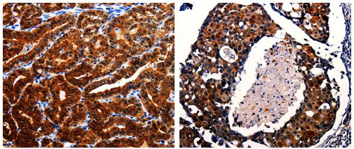 AK1 Antibody