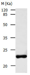 AK1 Antibody