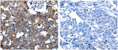 ANGPTL3 Antibody