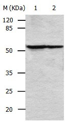 VIM Antibody