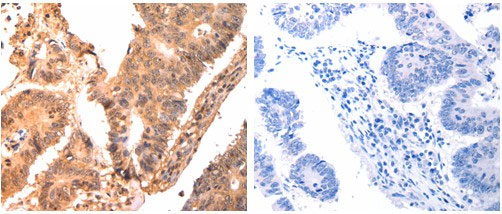 CAPNS1 Antibody