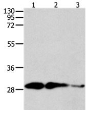 CAPNS1 Antibody