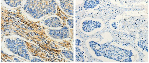 CAP1 Antibody