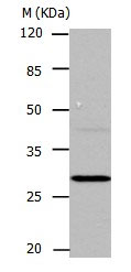 CA1 Antibody