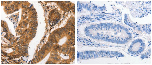 CA2 Antibody