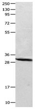 CA2 Antibody