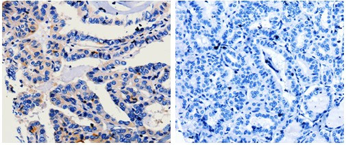 CA3 Antibody