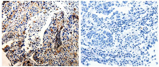 CTSZ Antibody