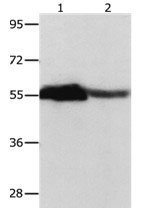 CBX2 Antibody