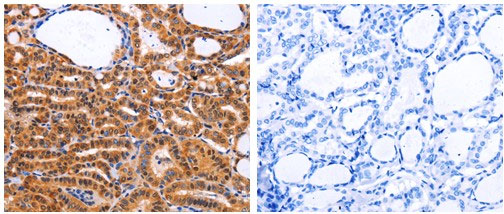 CDK4 Antibody