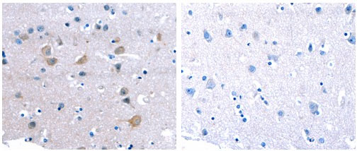 CDK5 Antibody