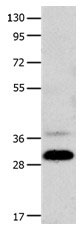 CDK5 Antibody