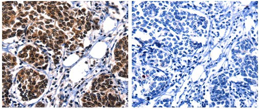 CSNK2A1 Antibody