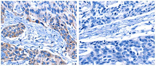 CNGA2 Antibody