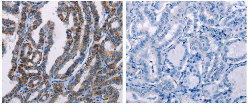 FHIT Antibody