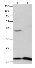 FHIT Antibody