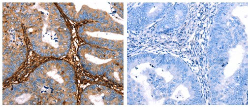 LGALS1 Antibody