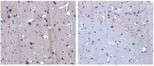 LGALS2 Antibody