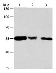 CALR Antibody