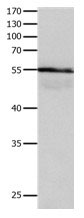 HP Antibody