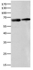 IGF2BP2 Antibody