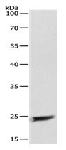 MAD2L1 Antibody