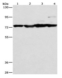 MMP15 Antibody