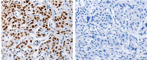 MUTYH Antibody