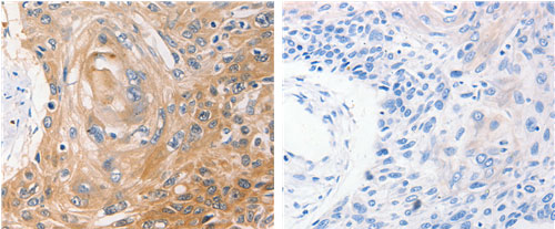 NME1 Antibody