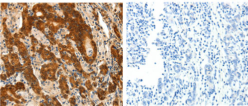 PTGDS Antibody