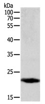 PTGDS Antibody