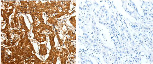 CDH23 Antibody