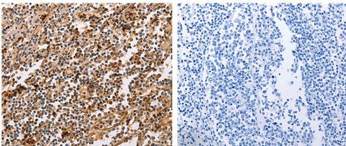 PPP1CB Antibody