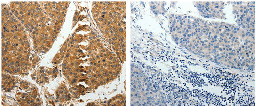 RRM1 Antibody