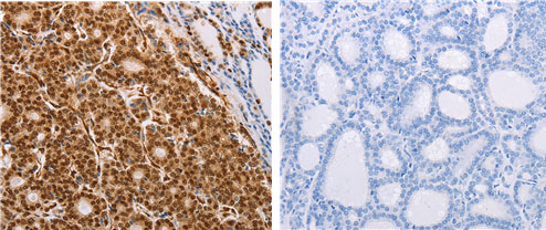 PSMD3 Antibody