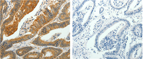 PTPN6 Antibody