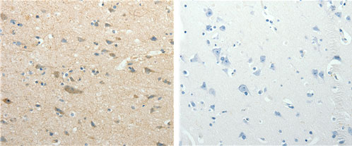 SIRT3 Antibody