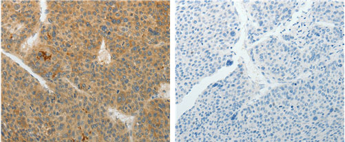 TEKT5 Antibody