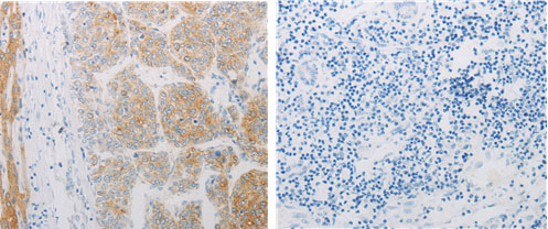 ADRB2 Antibody