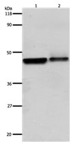 ADRB2 Antibody