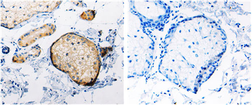 RAB6A Antibody