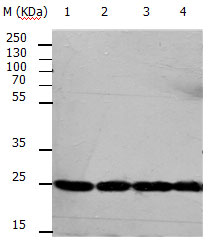 RAN Antibody