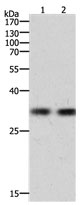 HAVCR1 Antibody