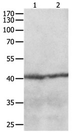 CCR8 Antibody