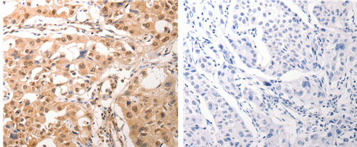 CDC6 Antibody