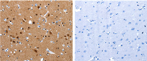 CRMP1 Antibody