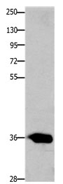 CCND2 Antibody