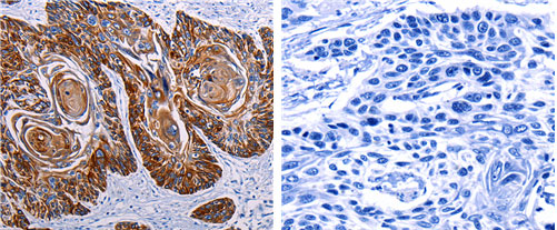 DEFA1 Antibody