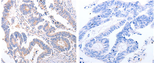 EIF4G2 Antibody